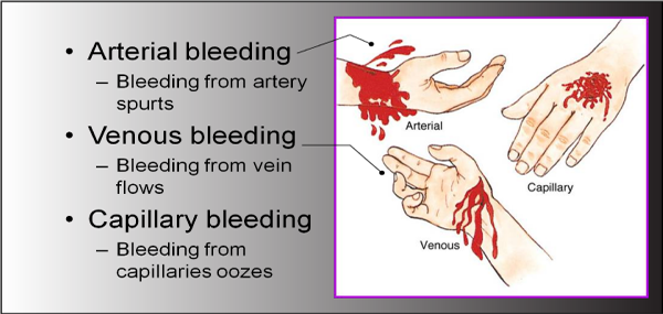 medical aid, Business Emergency protocol, Risk Management , Airway obstruction, 